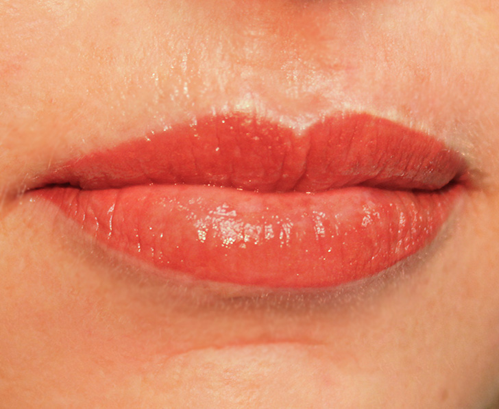 Permanent Lips