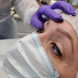 Eyeliner, During Procedure