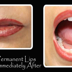 enhanced lip color and shape